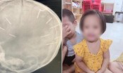 Bé gái 3 tuổi bị đóng đinh vào đầu: Bị đâm tới 10 cái đinh chứ không phải 9