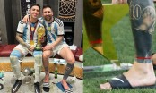 Sự thật cảm động đằng sau sợi dây đỏ trên chân trái của Messi