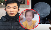 Hà Nội: Bé 3 tuổi bị đóng đinh vào đầu đã tử vong sau gần 2 tháng điều trị