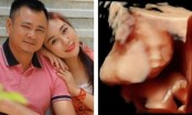 Vợ nghệ sĩ Tự Long thông báo mang thai lần thứ 3