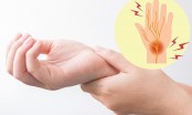 Nếu thường xuyên bị “tê tay”, bạn rất có thể đã mắc vào 4 căn bệnh nguy hiểm