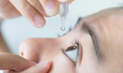 Không nên lạm dụng thuốc nhỏ mắt? 4 điều cần biết về thuốc nhỏ mắt!