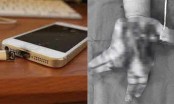 Thiếu niên 14 tuổi nát bàn tay do nổ điện thoại: Nguyên nhân phát nổ từ đâu?