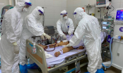 Bộ Y tế công bố 80 ca Covid-19 tử vong tại 6 tỉnh thành trong vòng 10 ngày