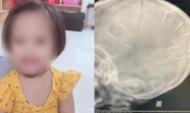 Nghi phạm vụ bé gái 3 tuổi bị đóng đinh vào đầu: Từng chia sẻ bài viết về cách chăm sóc trẻ em