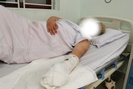 Hải Phòng: Thanh niên bị chém đứt 2 ngón tay nghi vì 