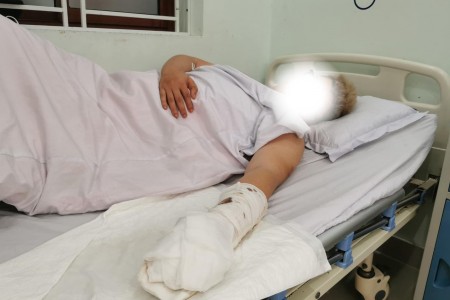 Hải Phòng: Thanh niên bị chém đứt 2 ngón tay nghi vì 'nhìn đều' người lạ