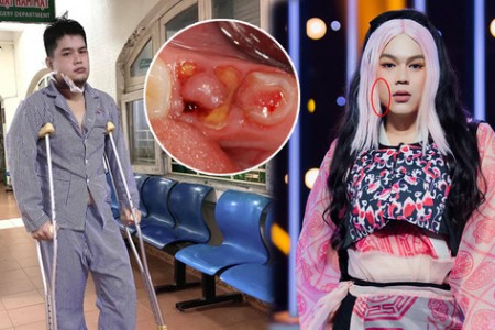 Hot Tiktoker Long Chun rút khỏi 'Gương Mặt Thân Quen' vì bị u men xương hàm