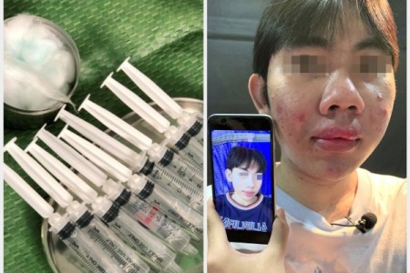 Trà Vinh: Ra chợ mua silicon 'xách tay Thái lan' về tự tiêm để làm đẹp, nạn nhân 10x bị biến dạng mặt, lở loét khắp người
