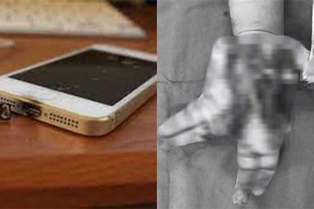 Thiếu niên 14 tuổi nát bàn tay do nổ điện thoại: Nguyên nhân phát nổ từ đâu?