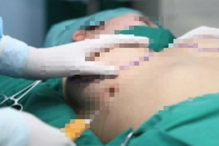 Vụ cô gái tử vong khi nâng ngực: Bác sĩ thẩm mỹ xưng là nhà từ thiện, nhờ khâm liệm với giá 20 triệu đồng