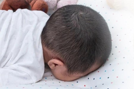 Hà Nội: Liên tiếp 2 trẻ đột tử khi ngủ - bác sĩ cảnh báo hội chứng nguy hiểm
